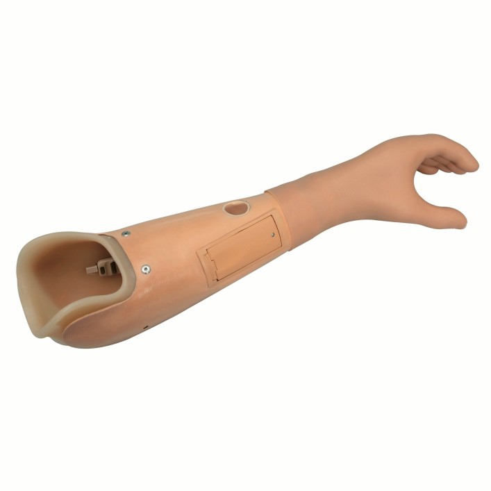 Below Elbow Myo Arm Prosthesis